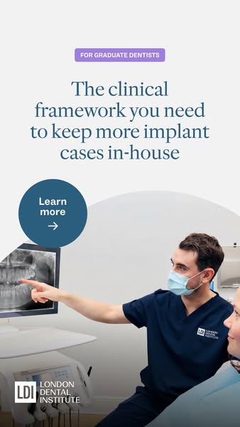 Keep implant cases in-house