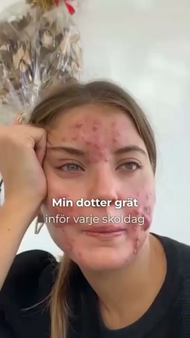 40% RABATT + Fri frakt