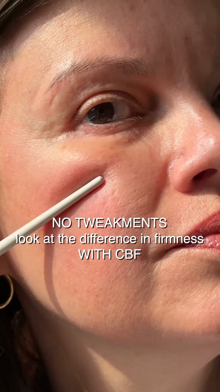 Girl, have you seen these results for wrinkles?