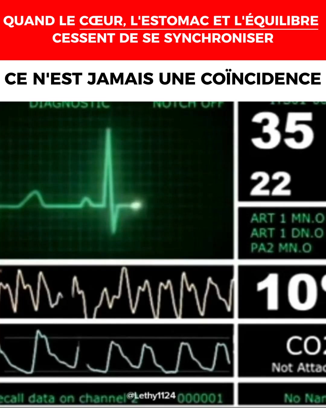 Pourquoi Vertiges, Tachycardie et Reflux Commencent Souvent dans le Cou