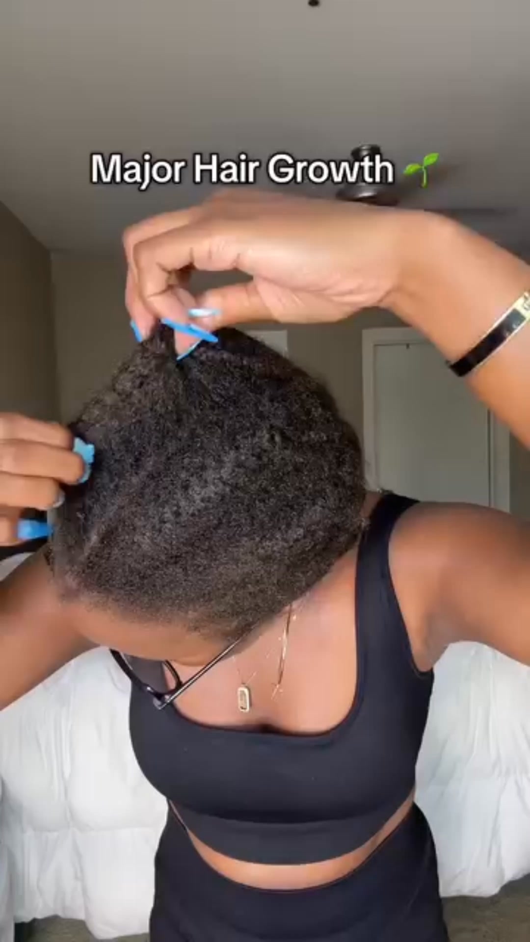 Vitamins That Will Give You Thicker & Healthier Hair