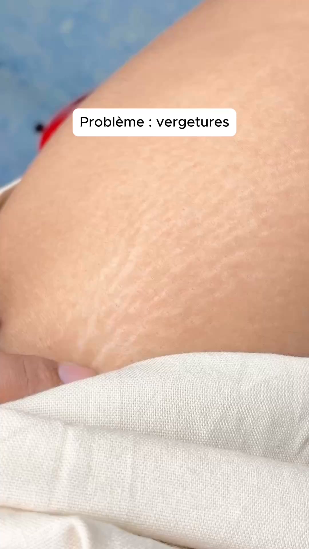 Le boost dont ma peau avait besoin