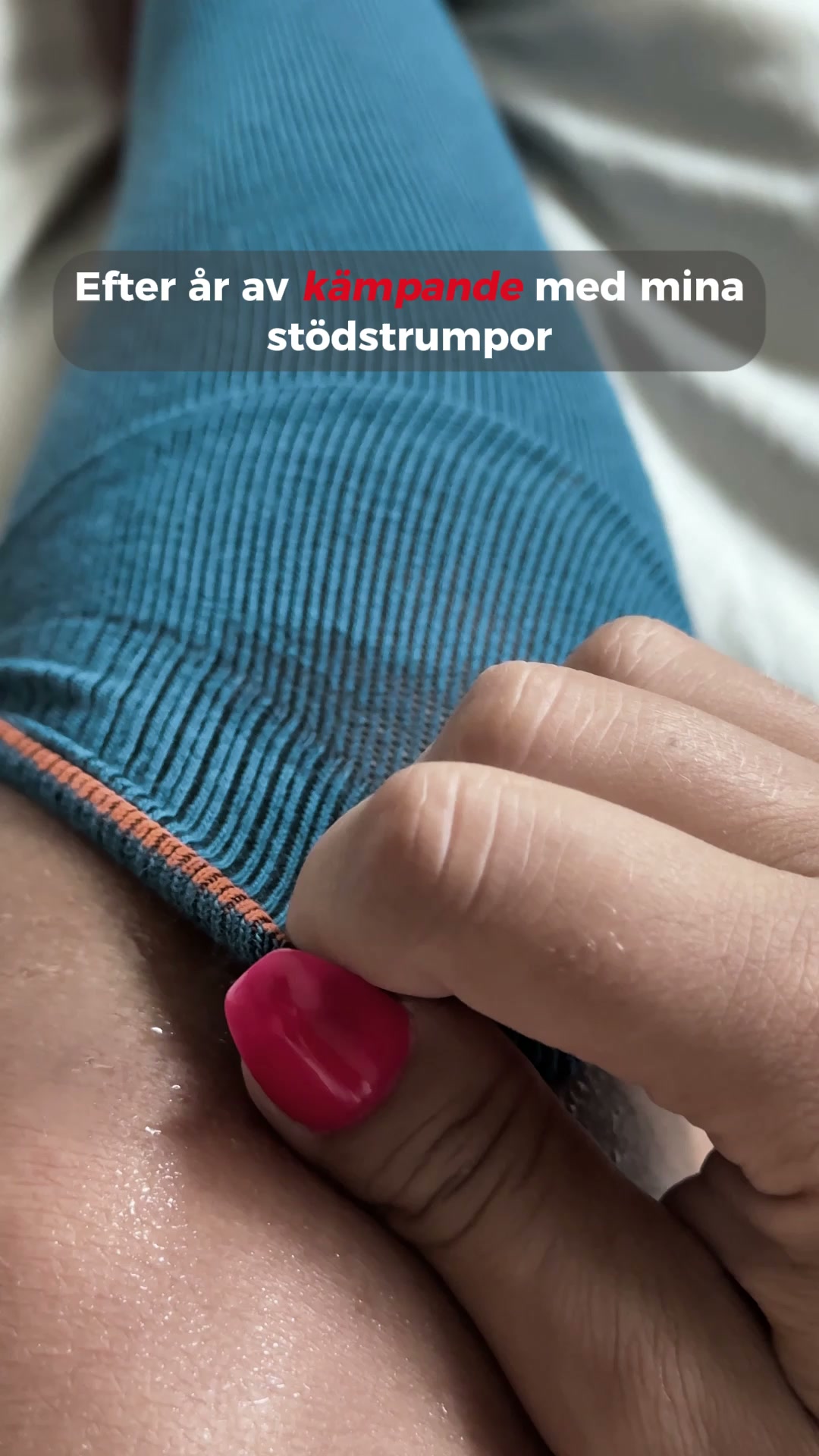 Ge dina ben det stöd de saknat
