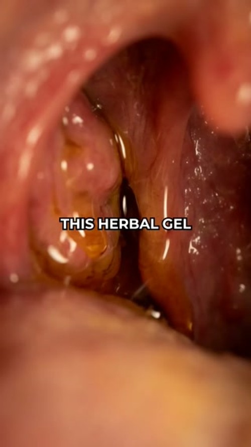 The real reason behind bad breath.