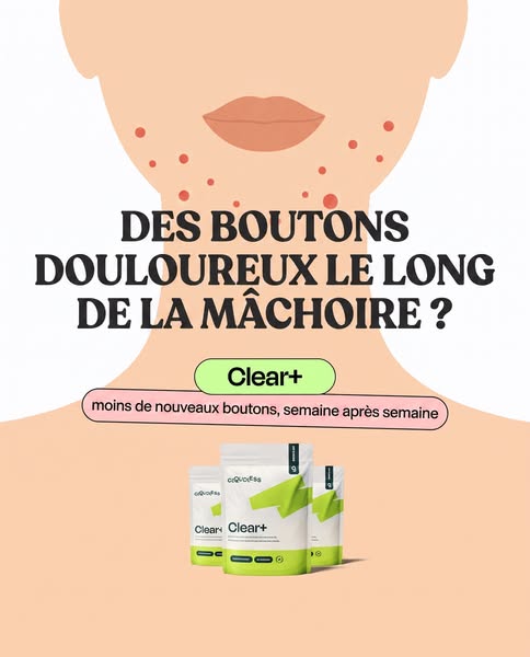 Tout essayé. Ça a vraiment marché.