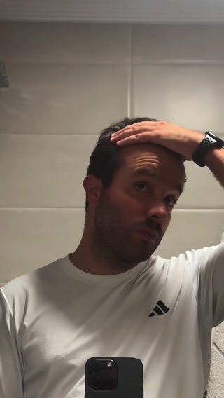 Recupera tu Cabello 5x Más Rápido—¡Ahorra Hasta 70% de Descuento!