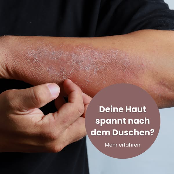 Kein Nachcremen mehr — 100 Tage risikofrei