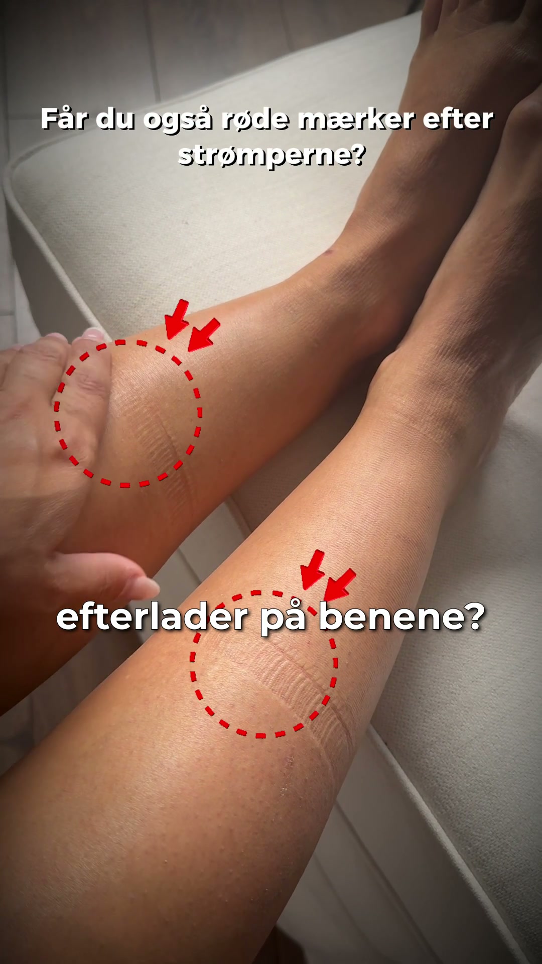 Slut med hævede ben!