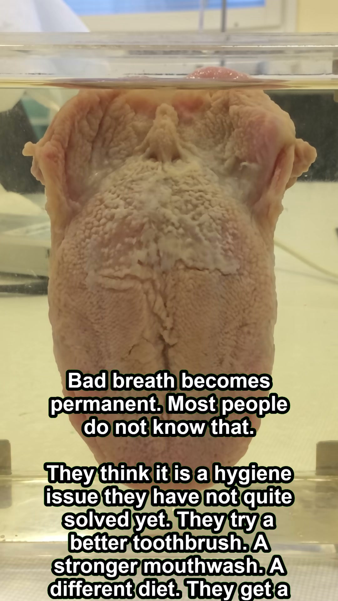 To people who have great hygiene and still can't get rid of bad breath — here's why nothing has worked.