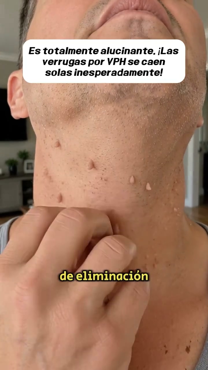 Oferta limitada -50%