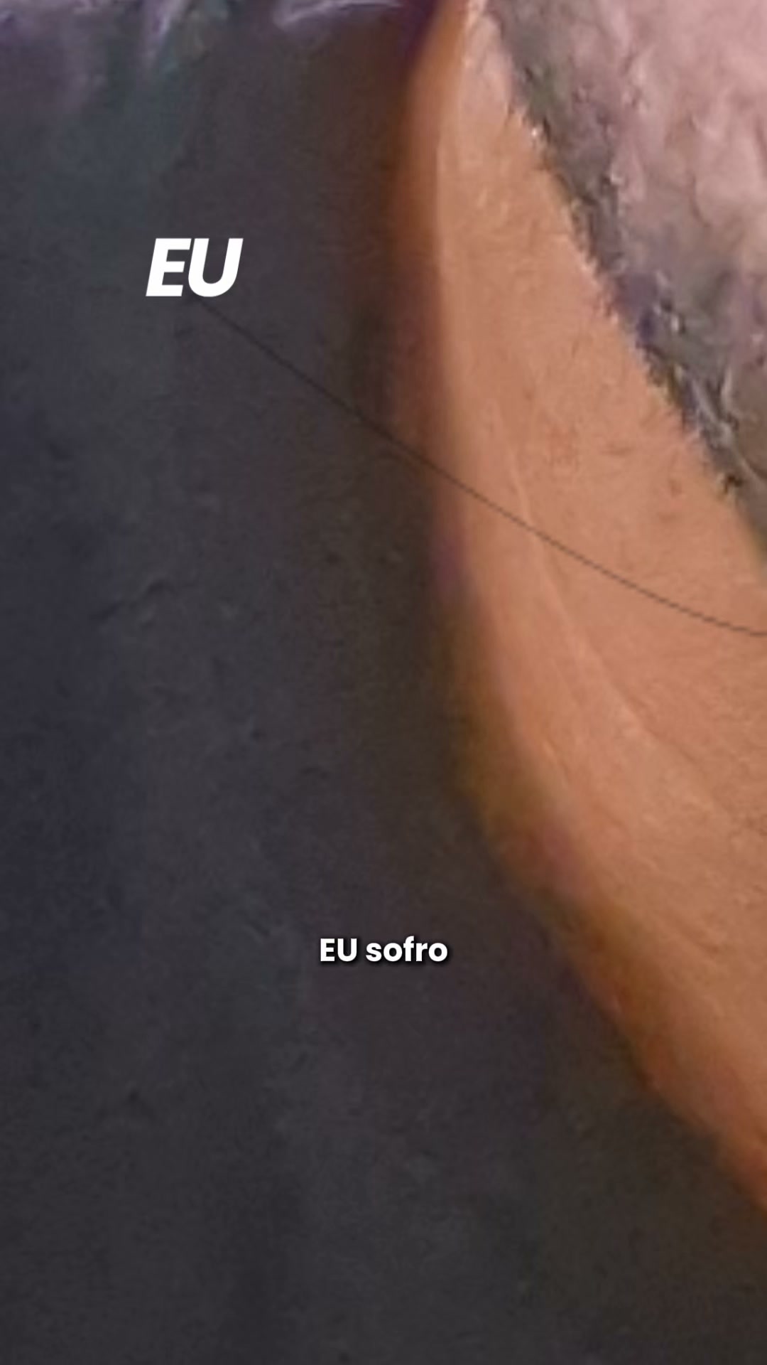 Alergias fecham o nariz. Isto abre.