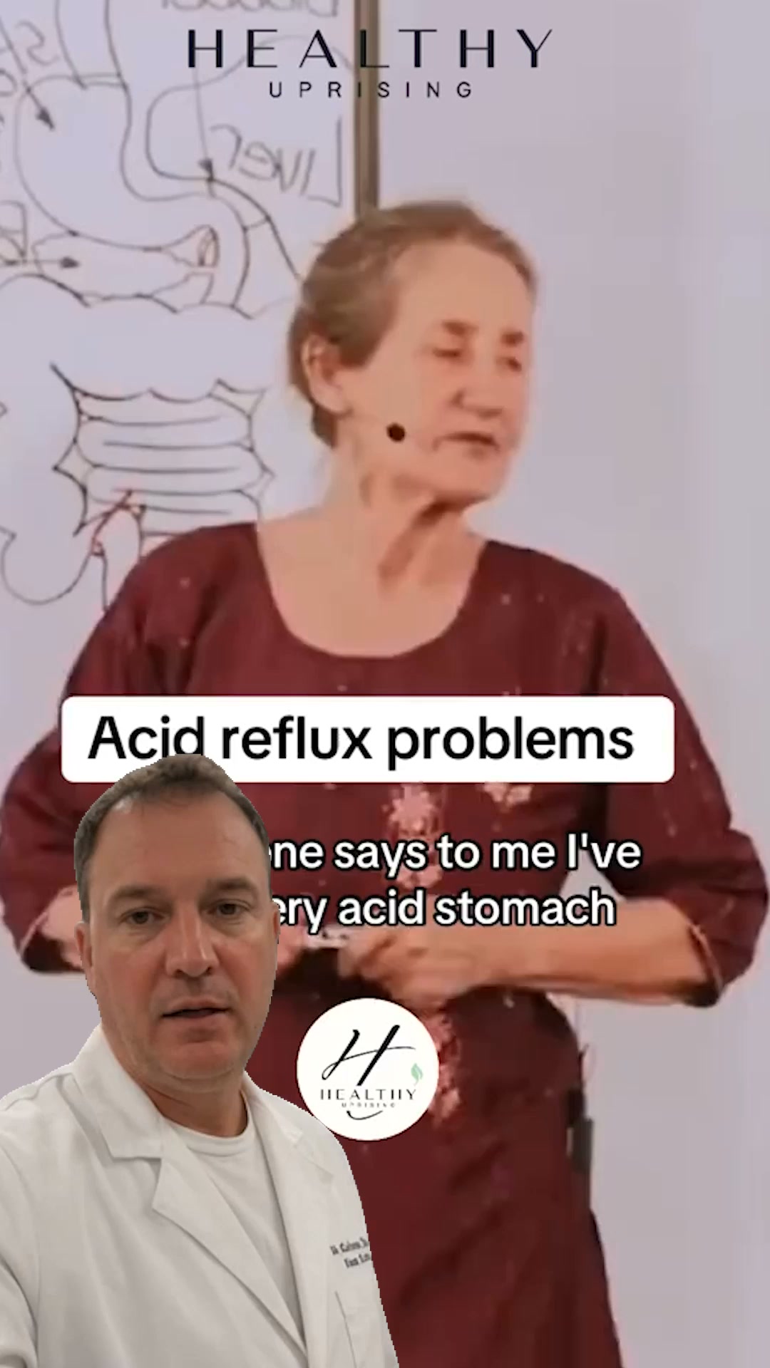 Reflux Relief Without an Acid Blocker