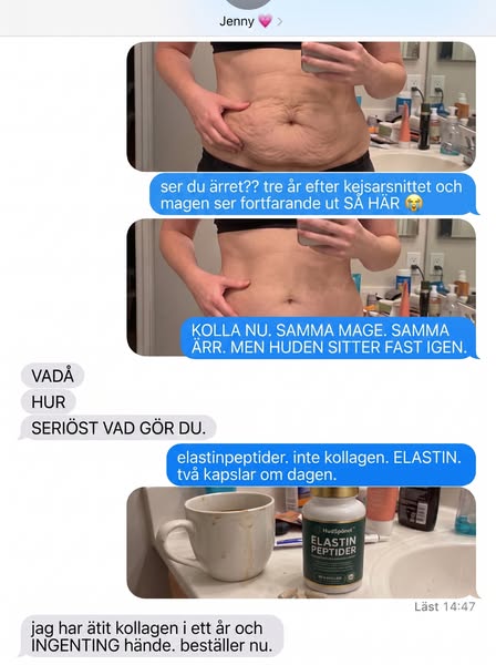 Forskare Hittade Proteinet Som Strammar Lös Hud