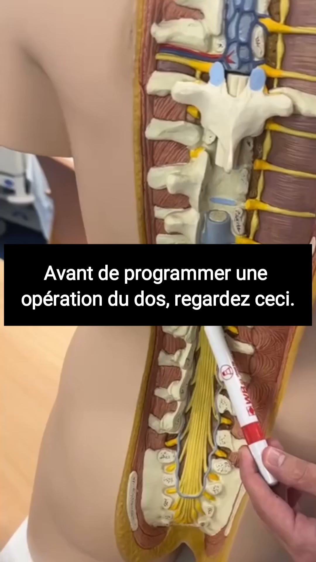 3 méthodes pour soulager les douleurs dorsales