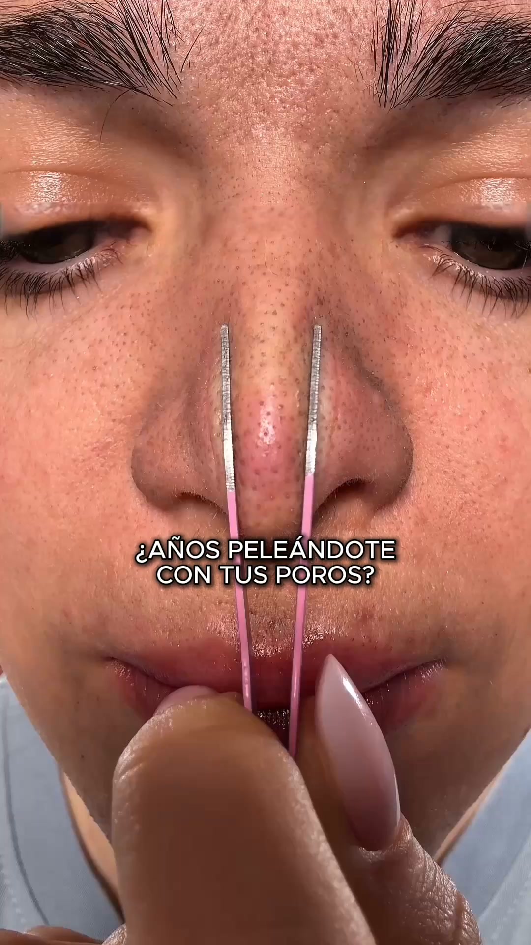 Adiós puntos negros - Sin tiras