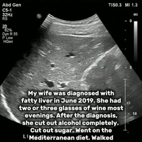 She quit drinking. Did everything right. Died anyway.