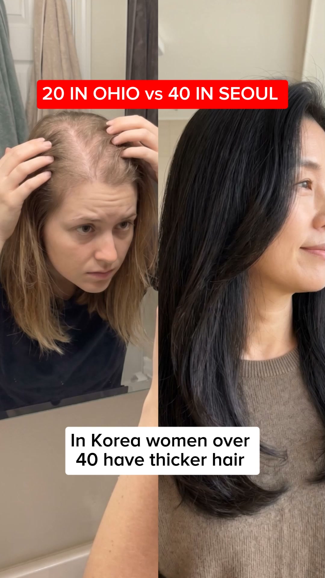 Korean Bar — Stop Hair Loss With 12 Herbs