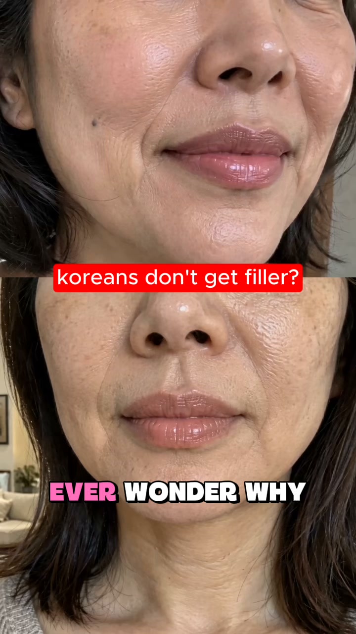 Before You Book Filler, Try Lipvia