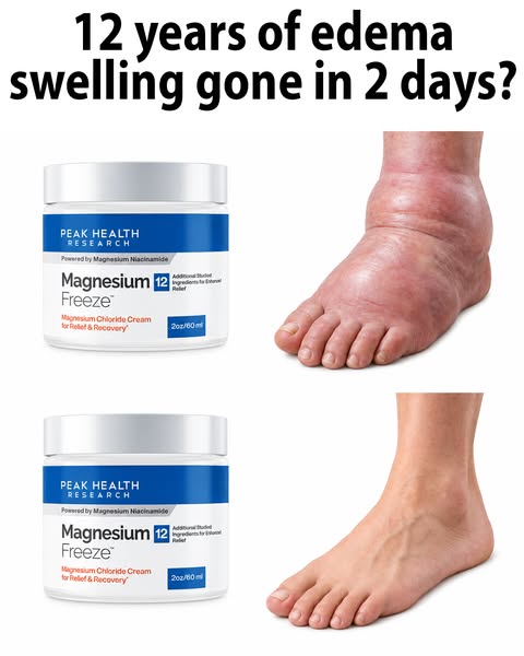"12 years of bone-on-bone knee pain gone in 2 days?"