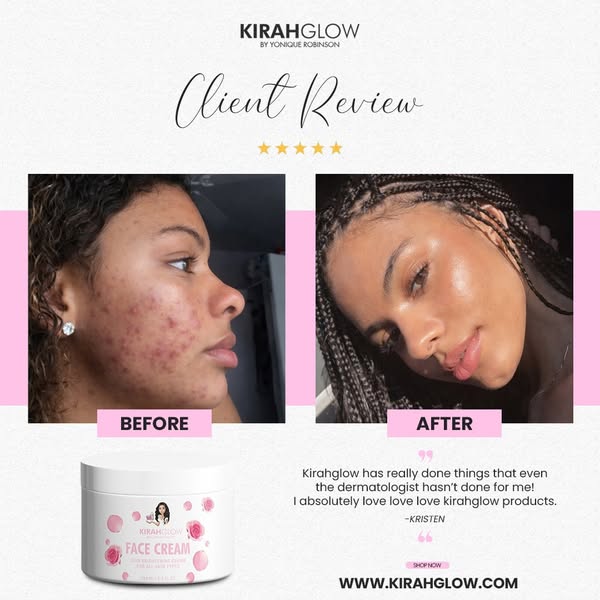 Kirah Glow LLC – Kirah Glow skincare line