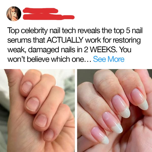 Top 5 Products That PROVE Damaged Nails Can Be Restored!