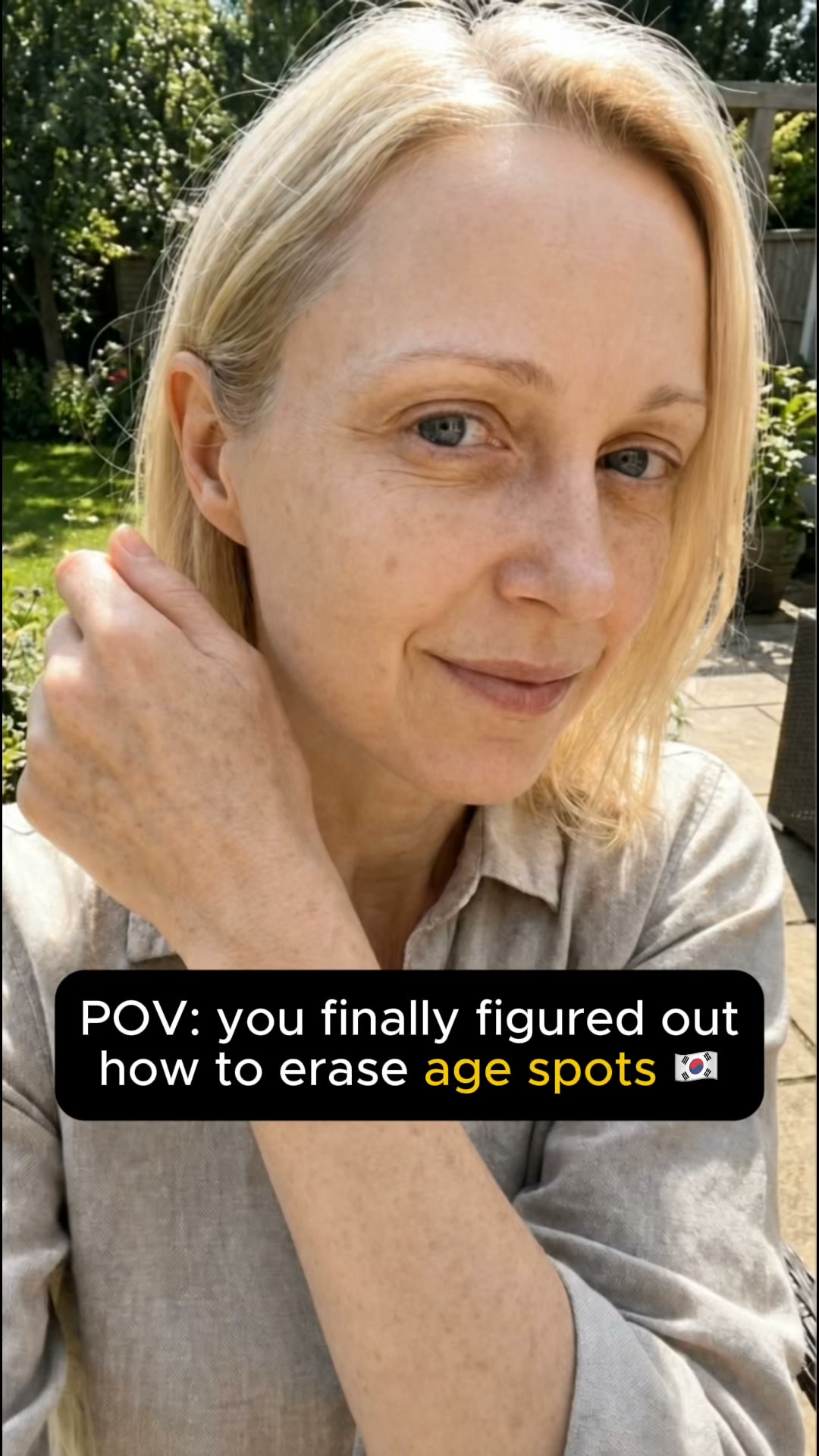 Why Sun Spots Hit the Hands First