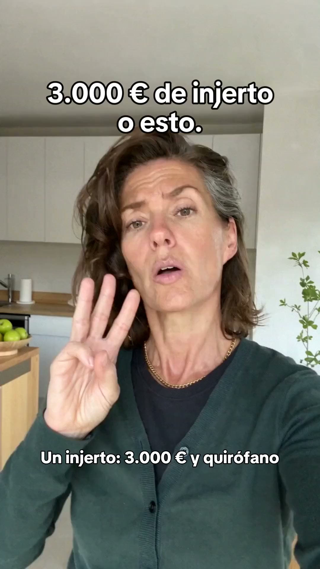 3.000 € de injerto o esto.