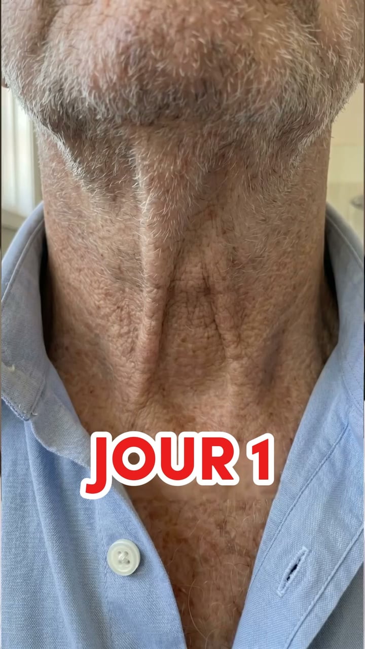 Une apparence plus forte et plus attirante