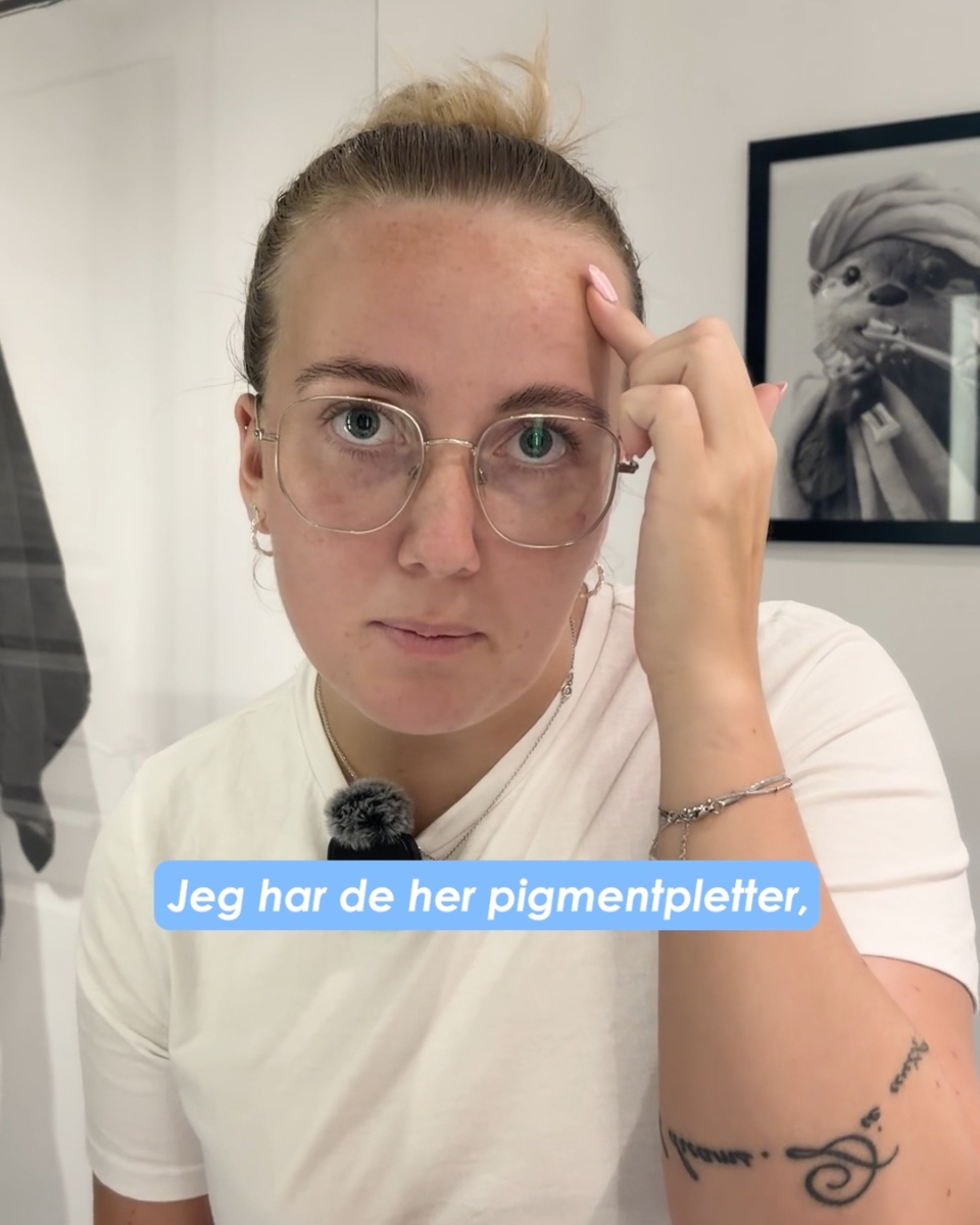Gør pigmentpletter mindre synlige
