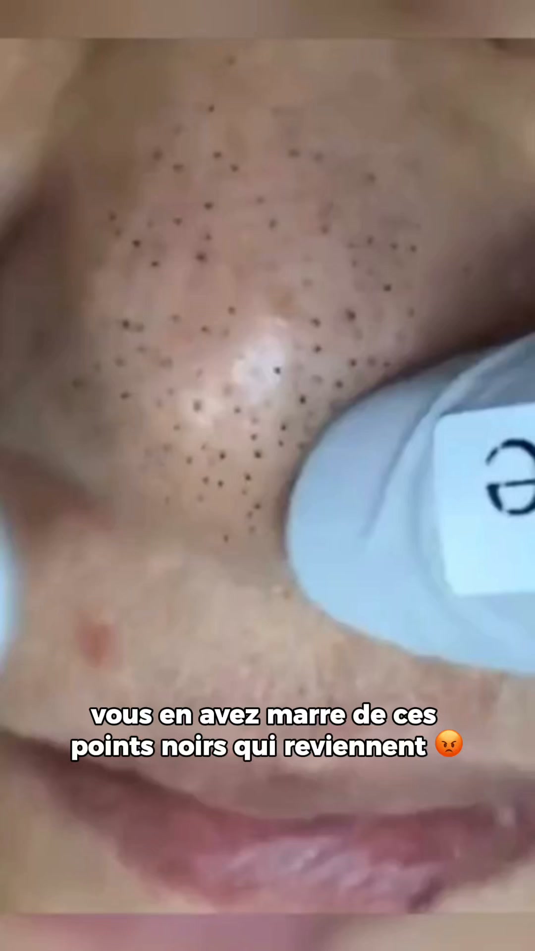 Transformez votre peau en 5 minutes !
