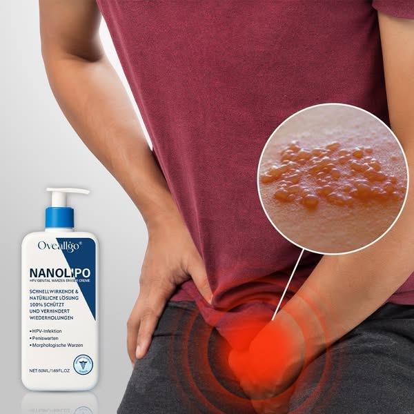 Oveallgo® NanoLipo HPV Genital Warts Eraser Cream