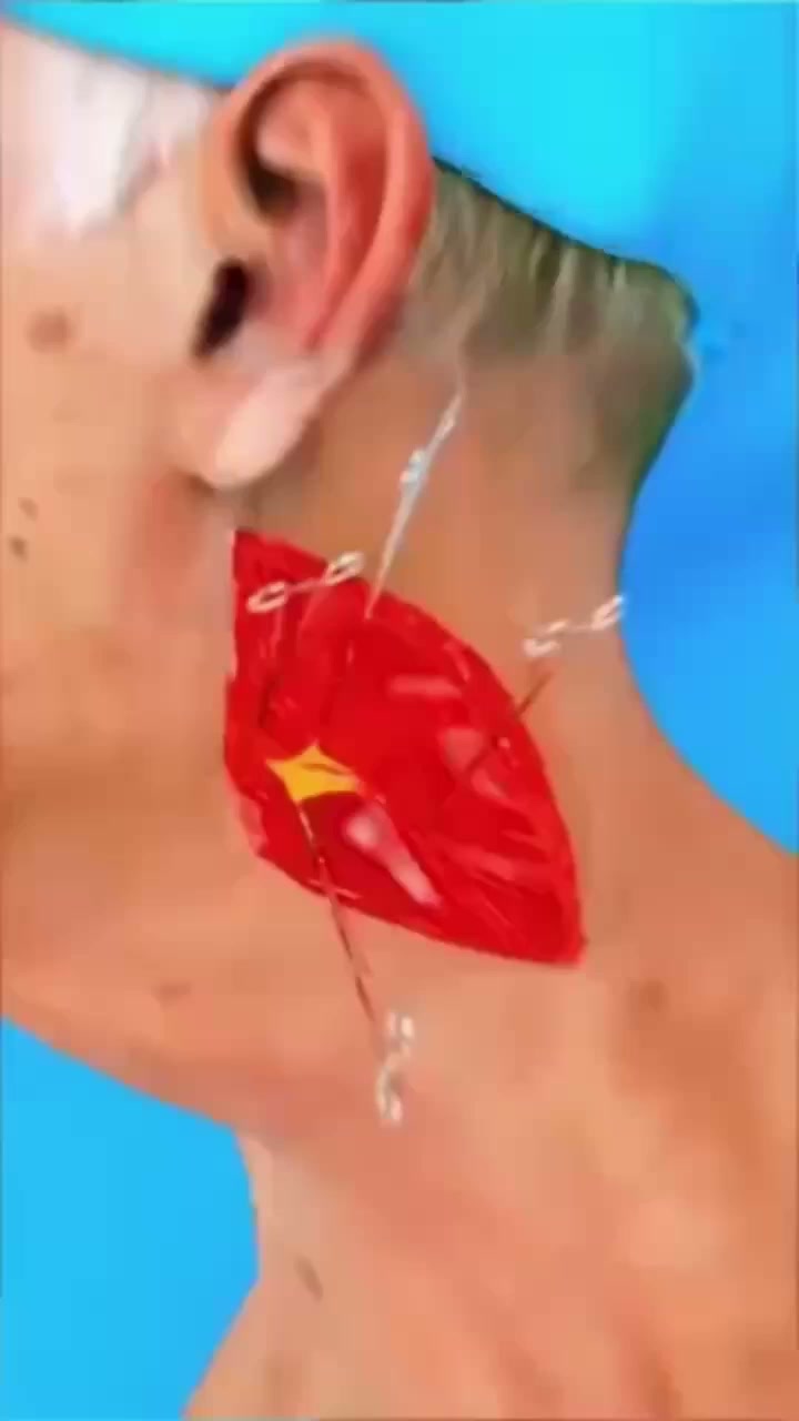 L'Erreur Que Tout le Monde Fait Avec la Tension Artérielle (Moi Aussi Je L'Ai Faite)