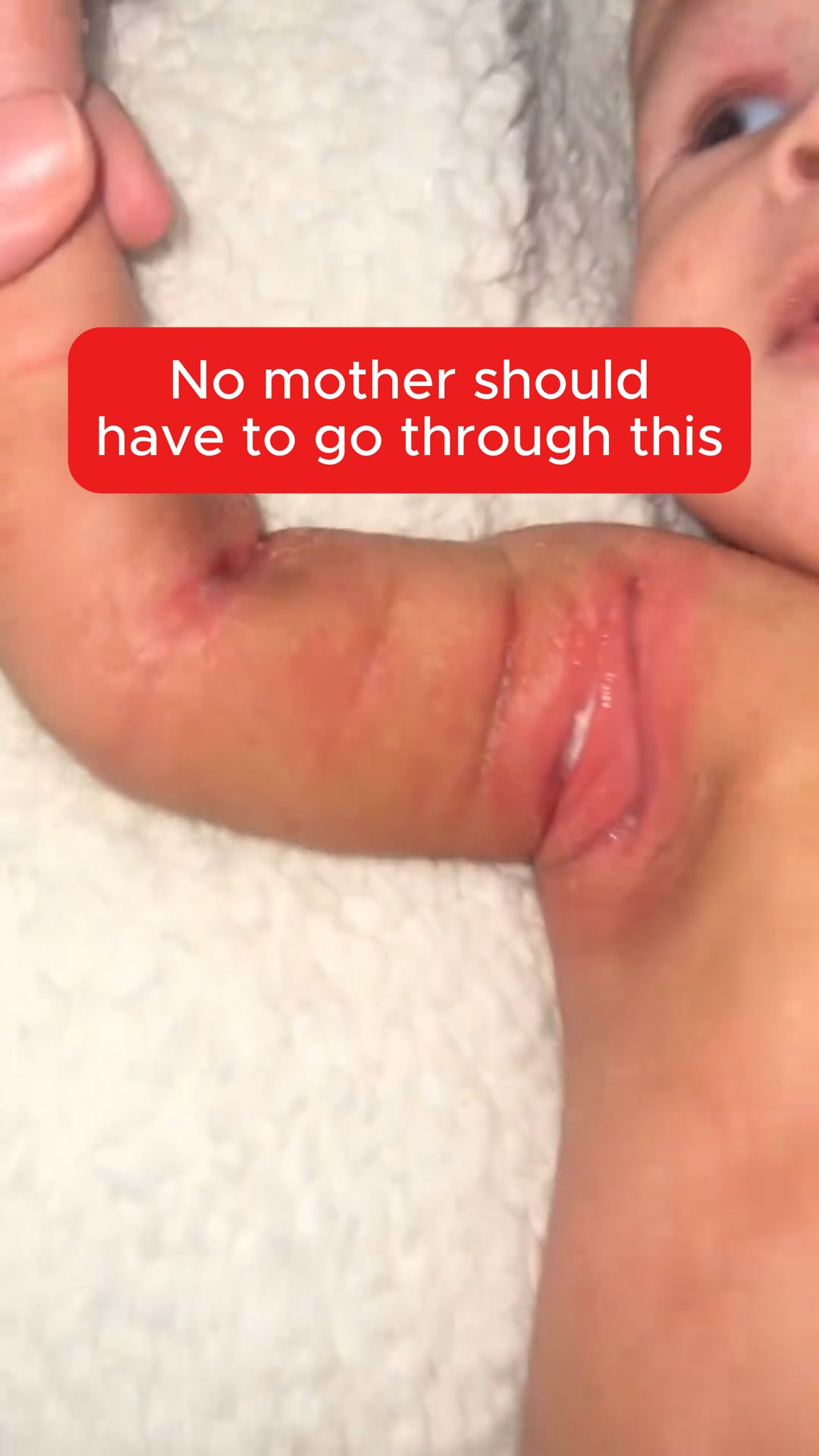 Clear Your Baby's Eczema in 30 Days — Or Your Money Back.