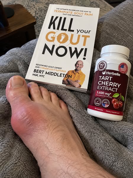 Get Your Life Back From Gout