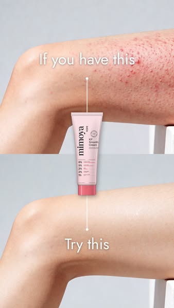 Say Goodbye to Strawberry Skin