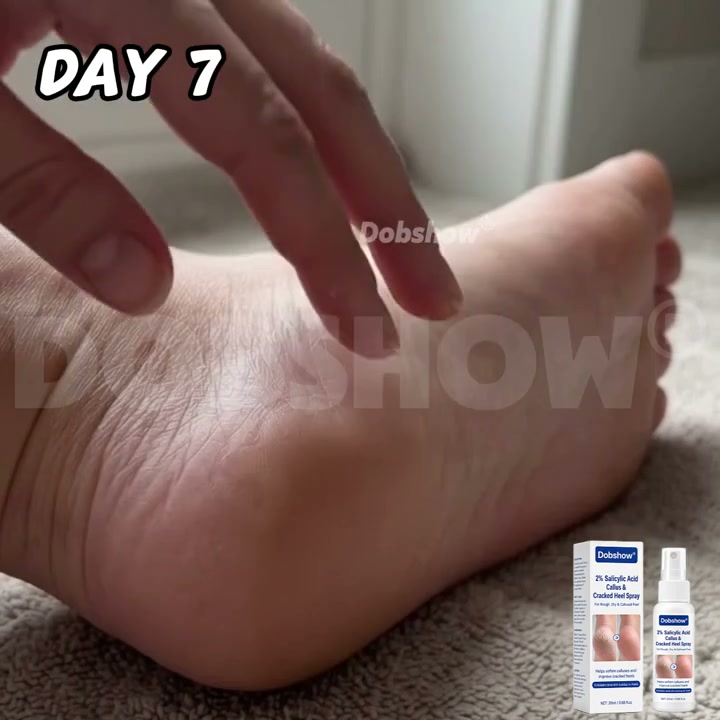 Shop Now — Fall Foot Care Starts Here