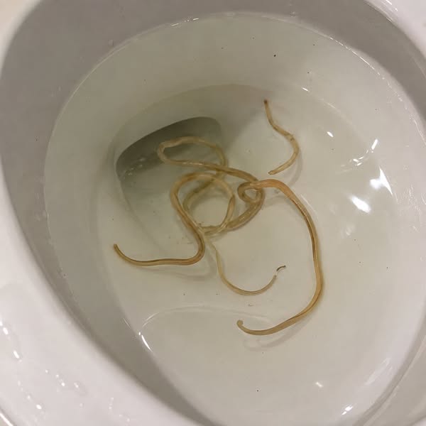 The AirBNB Guest Who Left a Parasite
