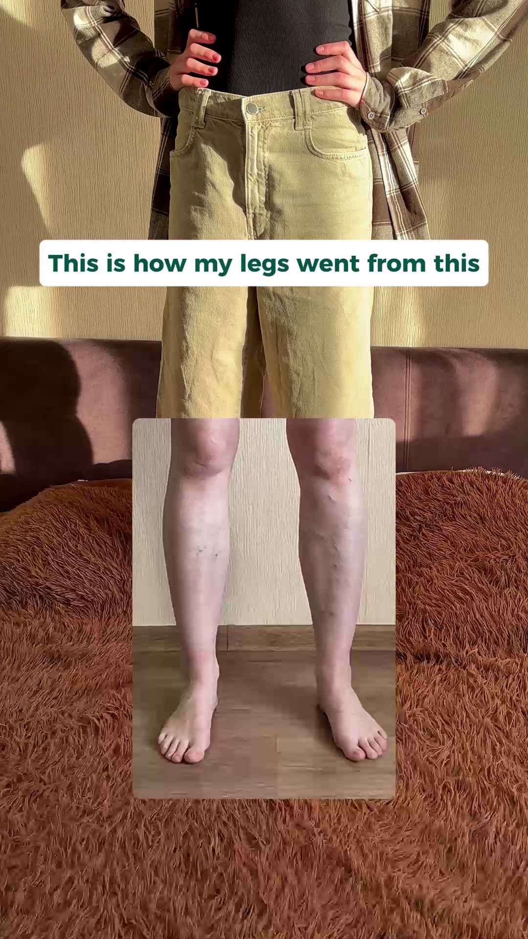 Give Your Legs the Support They've Been Missing