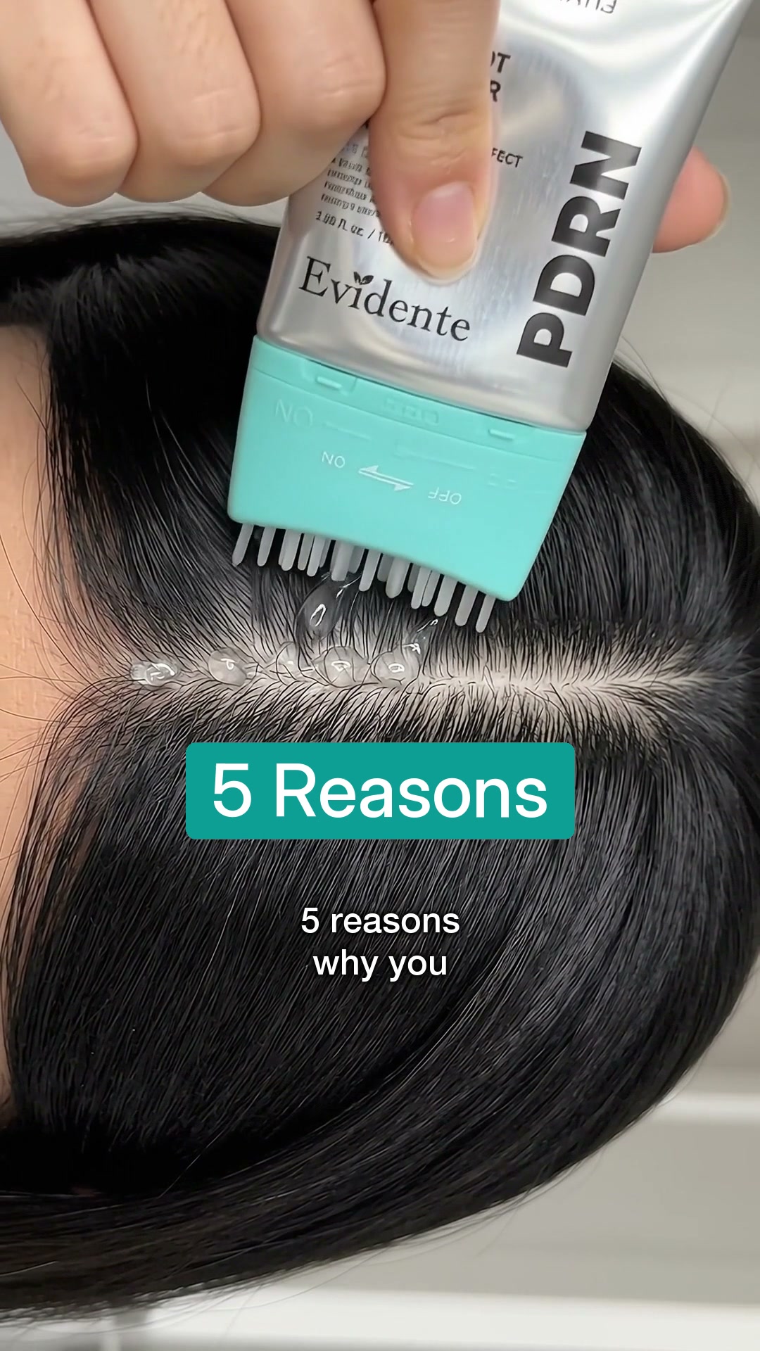 5 Reasons Women Switch to the Korean Scalp Shot