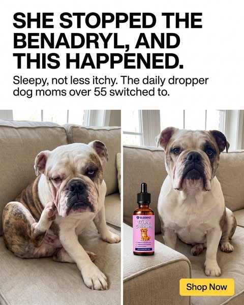 Benadryl made him sleepy, not less itchy
