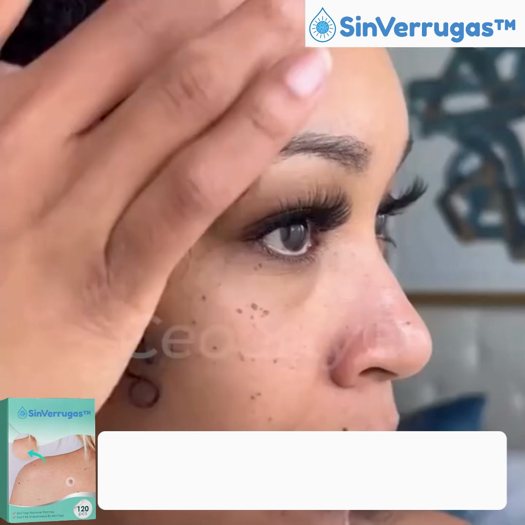 Elimina suavemente as verrugas e os sinais!