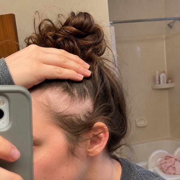 Stop Before You Give Up On Your Hair