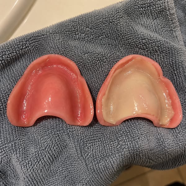 Read this if you wear dentures