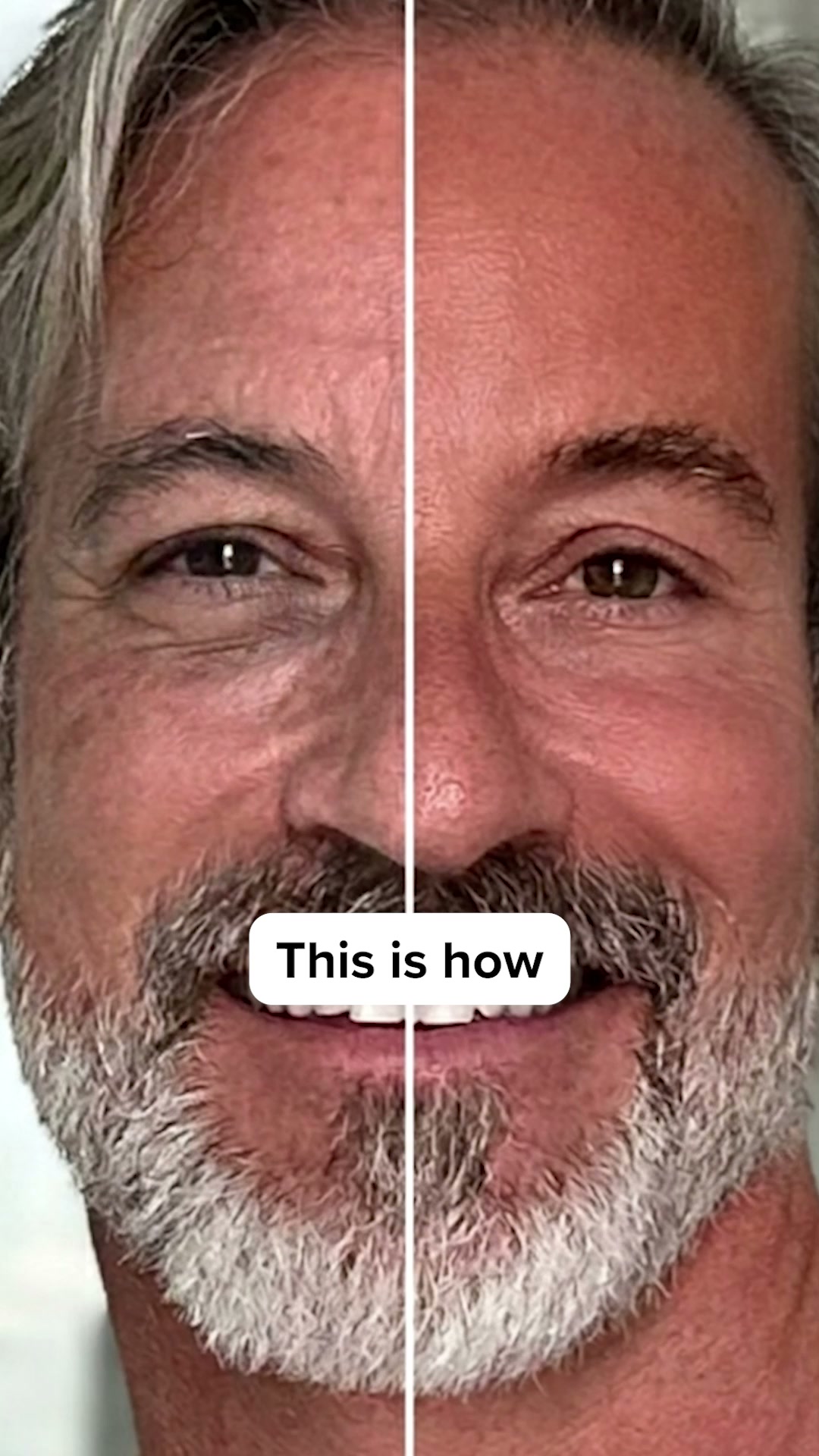 Finally Beat Eye Bags