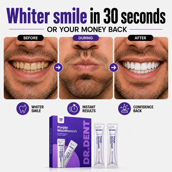 Whiter Smile In 30 Seconds Or It's Free