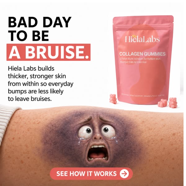 Read this if you wake up to bruises you cannot explain