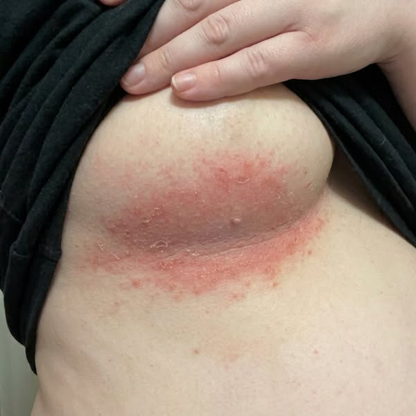 Feel Normal in Your Own Skin Again