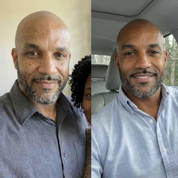 I Took Astaxanthin Pills for 6 Months. My Face Saw Nothing. Here's Why.