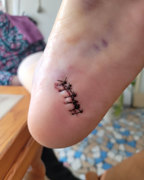 Lisez ça si la périménopause rend vos pieds douloureux au réveil