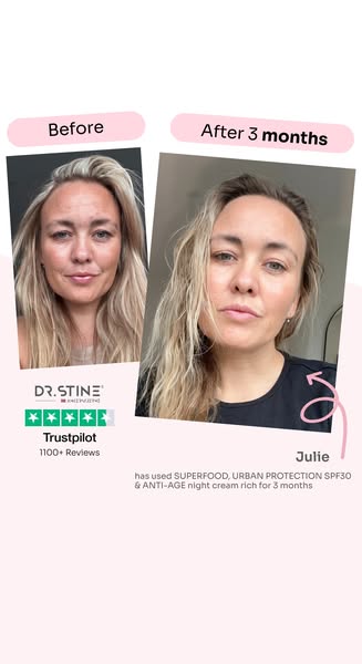 Winner of 11 Beauty Awards